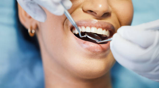 Best Emergency Dentist for Lost Fillings or Crowns in Tecumseh, OK