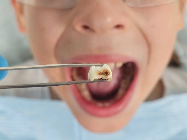 Best Orthodontic Emergency Dentist in Tecumseh, OK